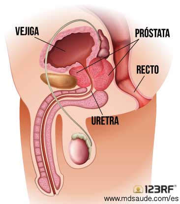 Prostatitis és uretritis különbségek